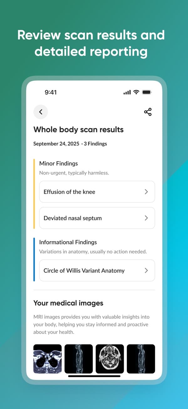 Prenuvo app showing minor and informational findings with MRI image thumbnails below